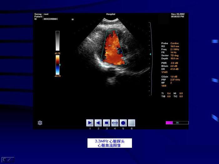 CMS1800 Color Doppler Ultrasonic Diagnostic System, Ultrasound